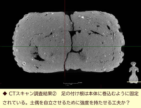 CTスキャン調査結果(2)_足.jpg